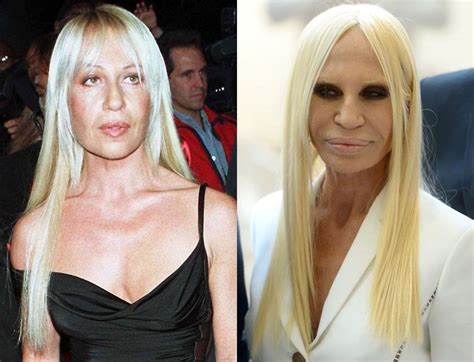 donatella versace office|Donatella Versace before and after surgery.